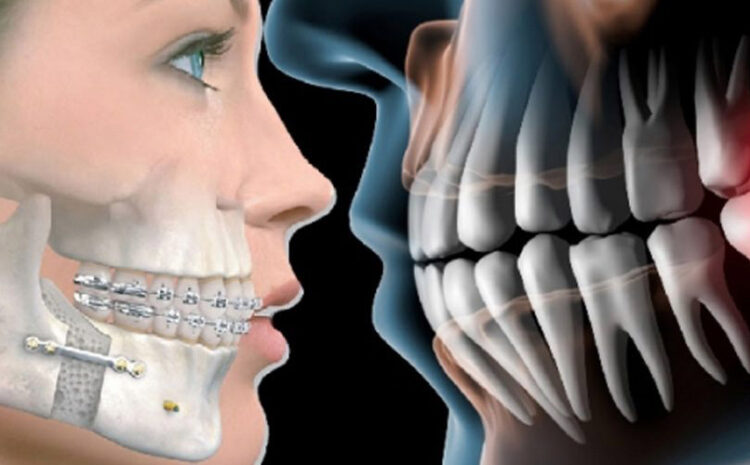  Soft Tissue Controversy Personal Injury Law