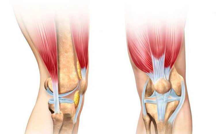  What is Knee ligament injury means? Personal Injury Law